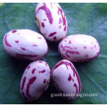 New Crop 180~200pcs/100g Wax Beans/Pinto Beans/Cranberry Beans